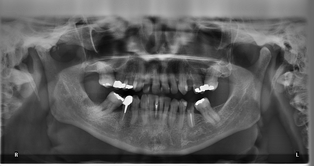 imagen radiografia dental